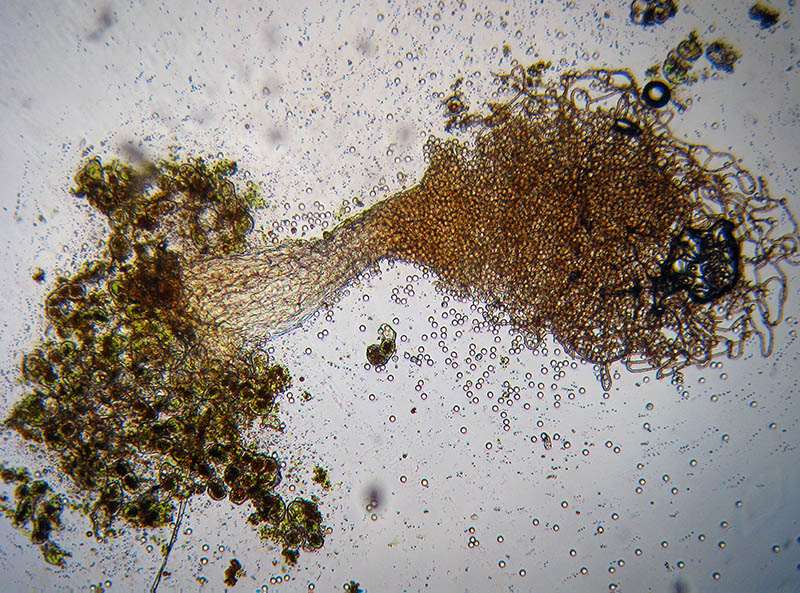 Arcyria (pomiformis ?)